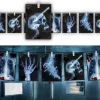 Halloweengirlang, radiographic photos 300 cm